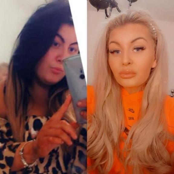 The Bolton News: CHANGE: Alice before and after The Bolton News: CHANGE: Alice before and after