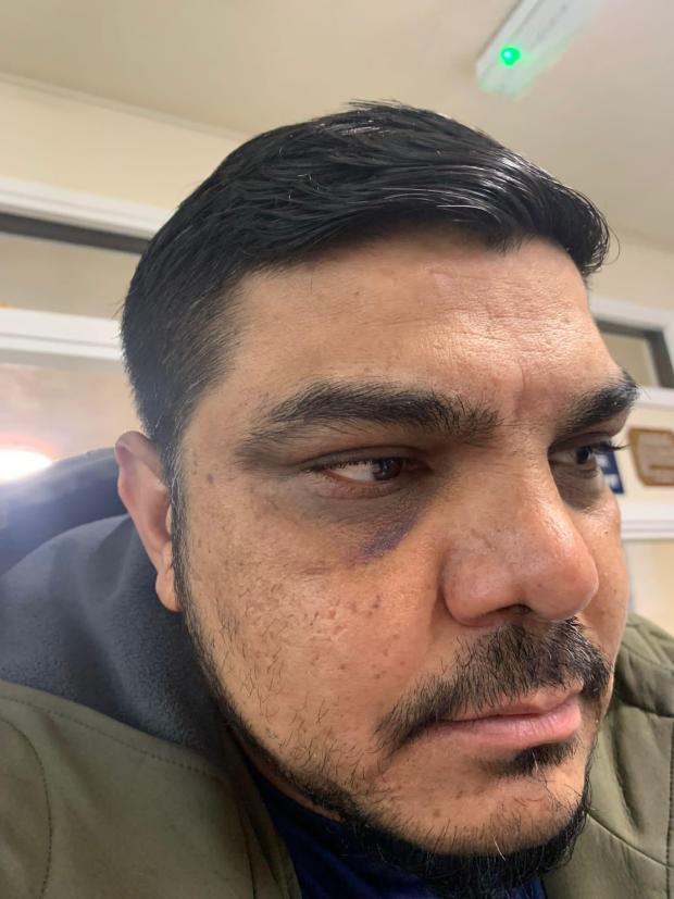 The Bolton News: Imtiyaz Mataq after being attacked