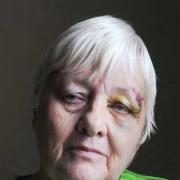 Attacked: Josephine Fadden was violently robbed by a hooded thug
