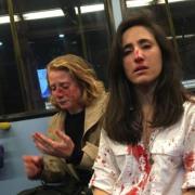 Lesbian couple beaten by gang of men in homophobic attack after refusing to kiss on bus